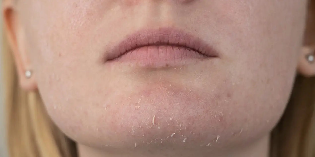 Creating a Winter Skin and Wellness Routine That Loves You Back